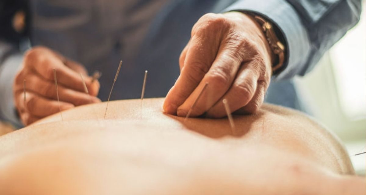 Acupunctura explicată: ce boli tratează și când este recomandată