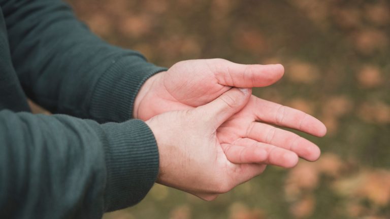 Tratamentul sindromului de tunel carpian dintr-o abordare integrativă